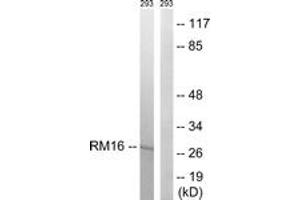 Western blot analysis of extracts from 293 cells, using MRPL16 Antibody.