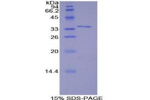 SDS-PAGE analysis of Human TRAF6 Protein. (TRAF6 Protéine)