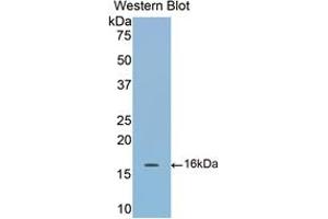 Western blot analysis of the recombinant protein. (COMP anticorps  (AA 40-180))