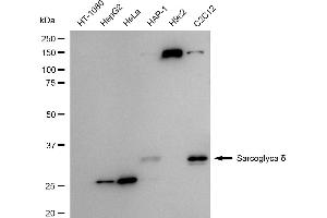 Western blotting analysis using Sarcoglycan delta antibody (ABIN7800272).