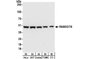 anti-Rab Geranylgeranyltransferase, beta Subunit (RABGGTB) (AA 281-331) antibody