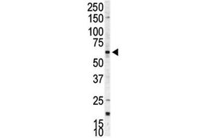 Western blot analysis of p70 S6 Kinase beta antibody and A375 cell lysate.