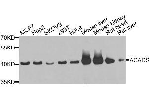 Western blot analysis of extracts of various cells, using ACADS antibody. (ACADS anticorps)