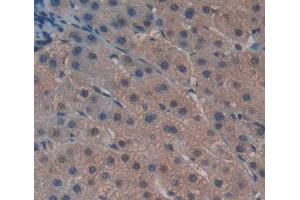 Used in DAB staining on fromalin fixed paraffin- embedded liver tissue (GTF2H5 anticorps  (AA 1-71))