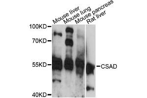 Western blot analysis of extracts of various cell lines, using CSAD antibody (ABIN6294199) at 1:3000 dilution. (CSAD anticorps)