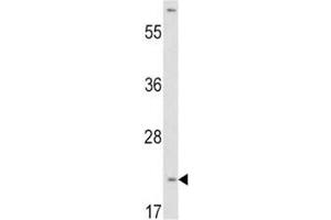 Western blot analysis of VHL antibody and HepG2 lysate. (VHL anticorps  (AA 43-71))