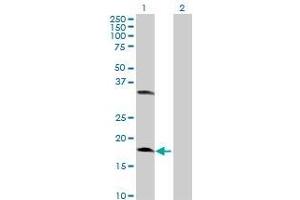 Lane 1: CETN2 transfected lysate ( 19. (CETN2 293T Cell Transient Overexpression Lysate(Denatured))