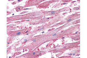 Anti-ATP6V1D antibody IHC of human heart.