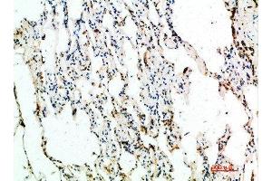 Immunohistochemical analysis of paraffin-embedded human-lung, antibody was diluted at 1:200 (ASCL1 anticorps  (AA 190-236))