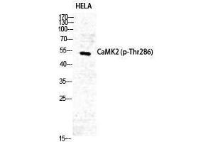 Western Blotting (WB) image for anti-CaMKIIalpha/delta (pThr286) antibody (ABIN3181941) (CaMKIIalpha/delta anticorps  (pThr286))