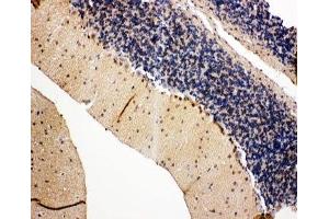 IHC-P: VCP antibody testing of rat cerebellum tissue (VCP anticorps  (C-Term))