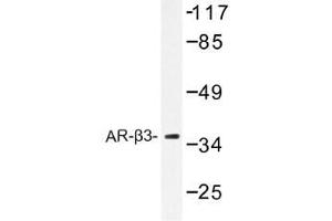 Image no. 1 for anti-Adrenergic, beta-3-, Receptor (ADRB3) antibody (ABIN317855) (ADRB3 anticorps)