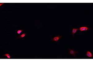 ABIN6266483 staining MCF-7 cells by IF/ICC. (HNRNPD/AUF1 anticorps  (Internal Region))
