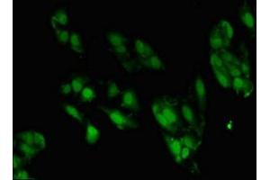 Immunofluorescent analysis of Hela cells using ABIN7176497 at dilution of 1:100 and Alexa Fluor 488-congugated AffiniPure Goat Anti-Rabbit IgG(H+L)