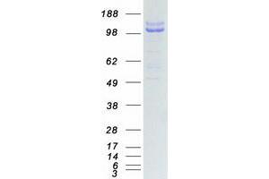 Validation with Western Blot