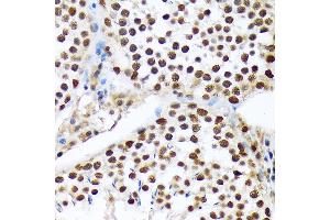 Immunohistochemistry of paraffin-embedded rat testis using PRP19 Rabbit mAb (ABIN7269505) at dilution of 1:100 (40x lens). (PRP19 anticorps)