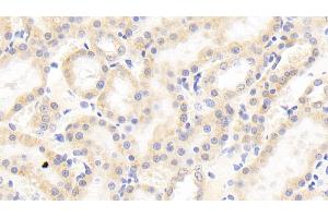 Detection of ANGPTL4 in Rat Kidney Tissue using Polyclonal Antibody to Angiopoietin Like Protein 4 (ANGPTL4)