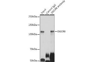 Immunoprecipitation analysis of 300 μg extracts of HeLa cells using 3 μg DGCR8 antibody (ABIN7266761). (DGCR8 anticorps)
