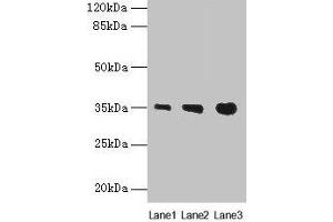 Western blot All lanes: PVRIG antibody at 4 μg/mL Lane 1: Mouse liver tissue Lane 2: Mouse kidney tissue Lane 3: Mouse heart tissue Secondary Goat polyclonal to rabbit IgG at 1/10000 dilution Predicted band size: 35 kDa Observed band size: 35 kDa (PVRIG anticorps  (AA 193-326))