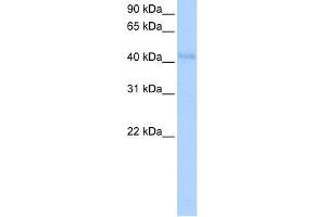 WB Suggested Anti-KLHDC5 Antibody Titration:  0. (KLHDC5 anticorps  (N-Term))