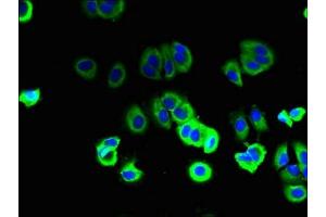 Immunofluorescent analysis of MCF-7 cells using ABIN7175455 at dilution of 1:100 and Alexa Fluor 488-congugated AffiniPure Goat Anti-Rabbit IgG(H+L)