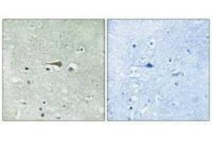 Immunohistochemistry analysis of paraffin-embedded human brain tissue using TTK (Ab-676) antibody.