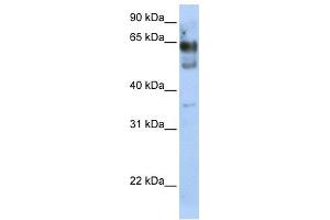 WB Suggested Anti-ZNF564 Antibody Titration:  0. (ZNF564 anticorps  (N-Term))