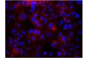 Immunofluorescence (IF) image for anti-Integrin beta 3 (ITGB3) antibody (ABIN2664787) (Integrin beta 3 anticorps)