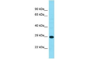 Western Blotting (WB) image for anti-Haloacid Dehalogenase-Like Hydrolase Domain Containing 3 (HDHD3) (C-Term) antibody (ABIN2791573) (HDHD3 anticorps  (C-Term))