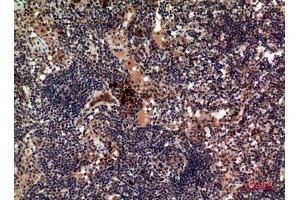 Immunohistochemistry (IHC) analysis of paraffin-embedded Human Lymph Nodes, antibody was diluted at 1:100.