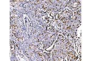 IHC analysis of Geminin/GMNN using anti-Geminin/GMNN antibody (ABIN7600598). (Geminin anticorps  (AA 21-196))