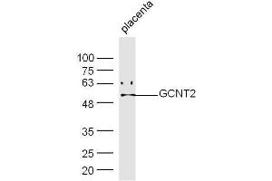 Mouse placenta lysates probed with Rabbit Anti-GCNT Polyclonal Antibody, Unconjugated  at 1:500 for 90 min at 37˚C.