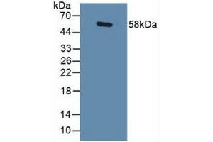 Detection of GABPa in Human Lung Tissue using Polyclonal Antibody to GA Binding Protein Transcription Factor Alpha (GABPa)
