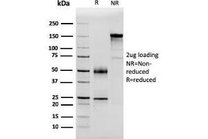 SDS-PAGE Analysis Purified PSA Mouse Monoclonal Antibody (APCS/3240). (APCS anticorps  (AA 143-223))