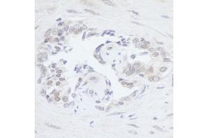 anti-Polymerase (RNA) III (DNA Directed) Polypeptide B (POLR3B) (AA 1083-1133) antibody