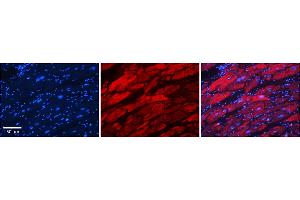Rabbit Anti-AARS Antibody    Formalin Fixed Paraffin Embedded Tissue: Human Adult heart  Observed Staining: Cytoplasmic Primary Antibody Concentration: 1:600 Secondary Antibody: Donkey anti-Rabbit-Cy2/3 Secondary Antibody Concentration: 1:200 Magnification: 20X Exposure Time: 0.