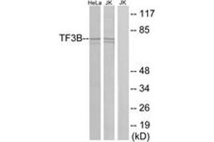 Western blot analysis of extracts from HeLa/Jurkat cells, using TF3B Antibody. (BRF1 anticorps  (AA 231-280))