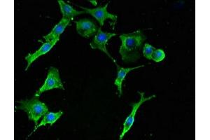 Immunofluorescent analysis of MCF-7 cells using ABIN7142512 at dilution of 1:100 and Alexa Fluor 488-congugated AffiniPure Goat Anti-Rabbit IgG(H+L)