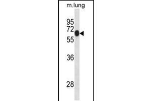 Western blot analysis in mouse lung tissue lysates (35ug/lane). (DYRK1B anticorps  (AA 376-403))