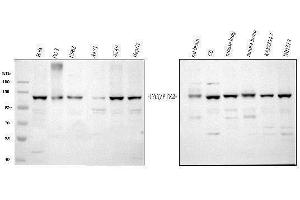 Western blot analysis of FAK/PTK2 using anti-FAK/PTK2 antibody (ABIN3043556).