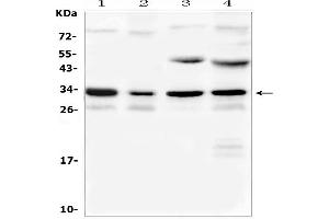 Western blot analysis of Aquaporin 3 using anti-Aquaporin 3 antibody (ABIN5518806).