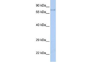 WB Suggested Anti-IGF1R Antibody Titration:  0. (IGF1R anticorps  (Middle Region))
