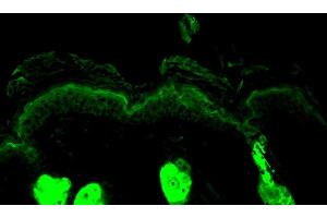 Immunohistochemistry analysis using Rabbit Anti-Calreticulin Polyclonal Antibody . (Calreticulin anticorps  (HRP))
