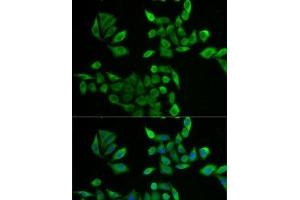 Immunofluorescence analysis of U2OS cells using PNP Polyclonal Antibody (PNP anticorps)