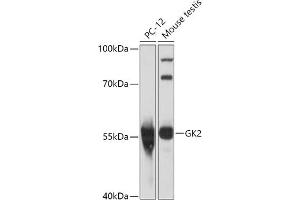 Western blot analysis of extracts of various cell lines, using GK2 antibody (ABIN7267458) at 1:1000 dilution. (GK2 anticorps  (AA 1-150))