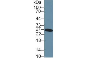 Detection of GSTa3 in Human Liver lysate using Polyclonal Antibody to Glutathione S Transferase Alpha 3 (GSTa3)