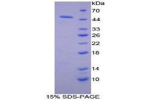 SDS-PAGE (SDS) image for Adiponectin Receptor 2 (ADIPOR2) (AA 2-155) protein (His tag,GST tag) (ABIN1877413)