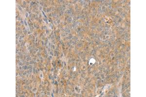 Immunohistochemistry (IHC) image for anti-Solute Carrier Family 8 (Sodium/calcium Exchanger), Member 3 (SLC8A3) antibody (ABIN2433861) (SLC8A3 anticorps)