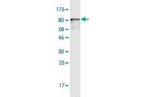 Western Blot detection against Immunogen (83. (Hexosaminidase A anticorps  (AA 1-529))