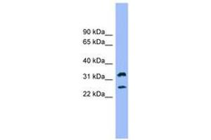 Image no. 1 for anti-Fc Fragment of IgE Receptor Ia (FCER1A) (AA 35-84) antibody (ABIN6744794) (Fc epsilon RI/FCER1A anticorps  (AA 35-84))